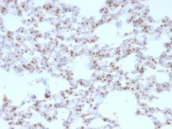 TTF-1/ NKX2-1 Antibody (NX2.1/690), Novus Biologicals 0.2mg; Unlabeled:Antibodies,